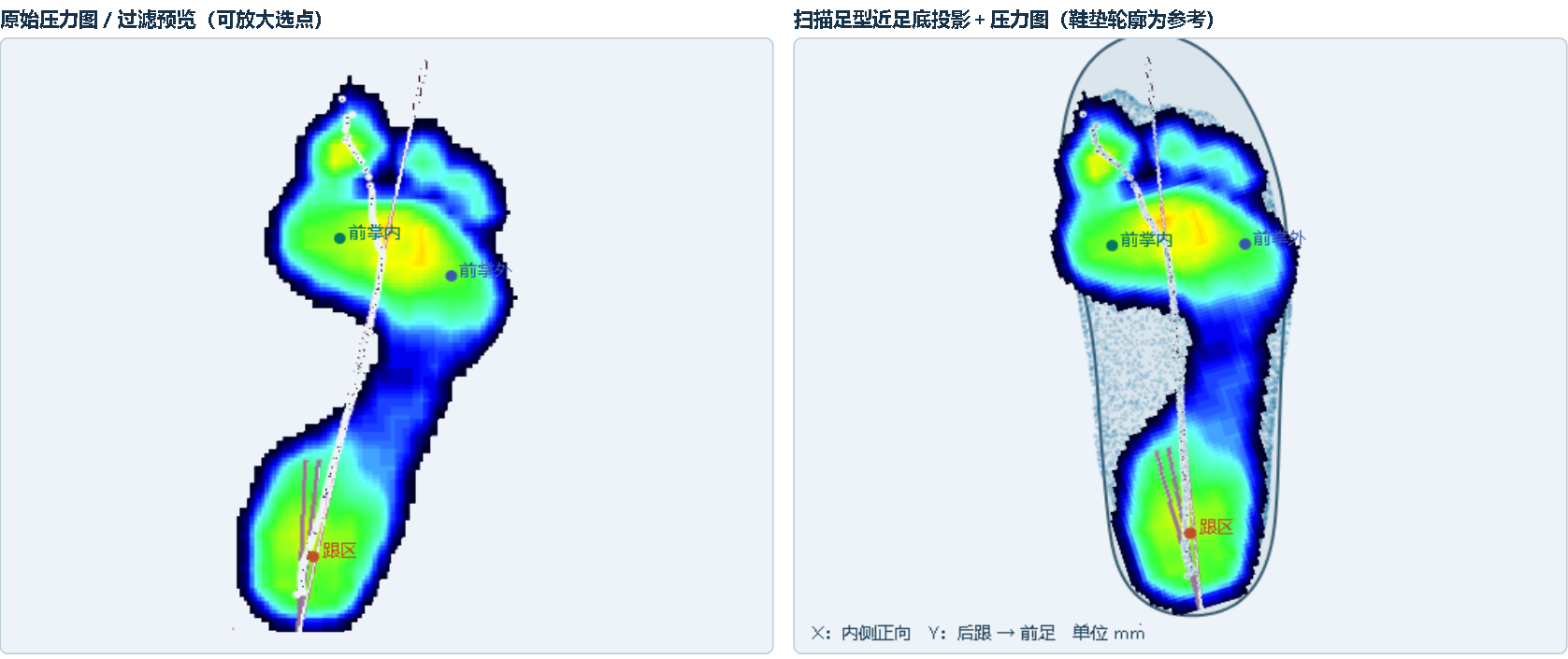 原始压力图与足型投影的配准叠加对照